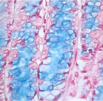 regulatory T-cells