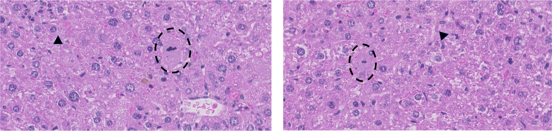 liver_histology